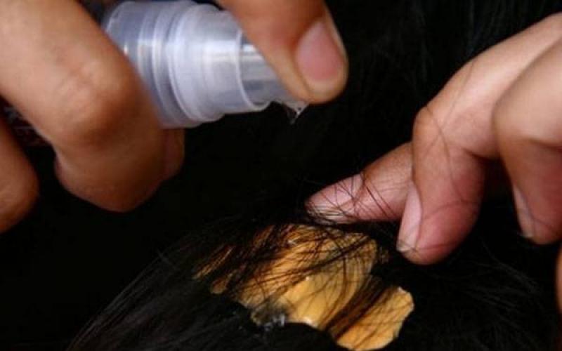 Чем снять жвачку с волос: замораживание, контрастный душ, масло, и когда не обойтись без стрижки Народные рецепты для быстрого удаления жевательной резинки