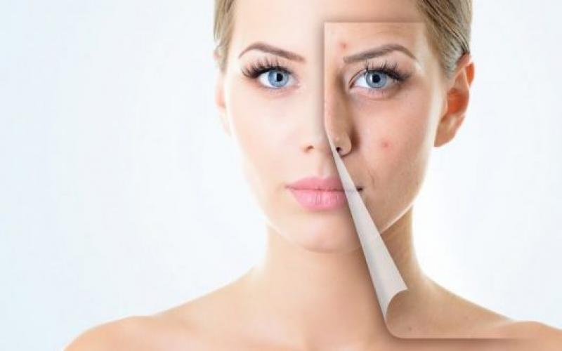 How to restore youthful skin: simple home recipes